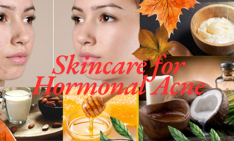 Best Skincare for Hormonal Acne (Easy & Effective Treatment Guide)